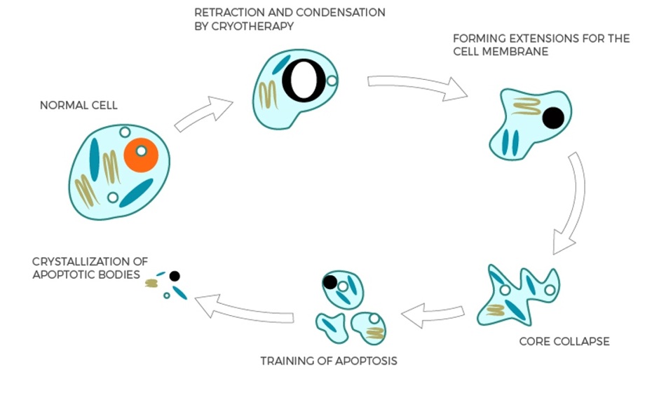 cryotherapy-cells