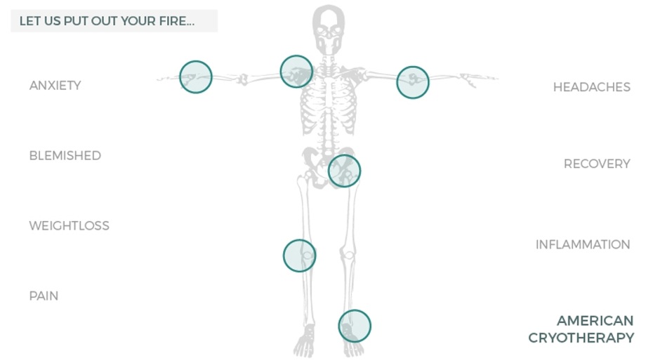 cryotherapy-whole-body-treatment