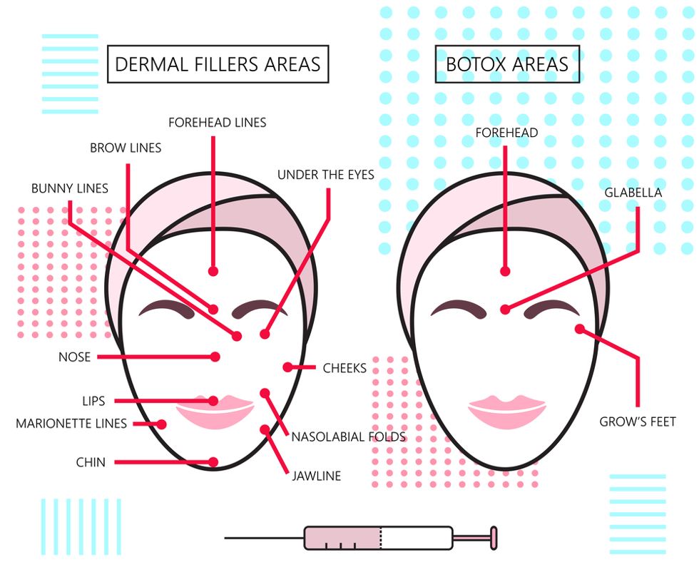 dermal-fillers-botox