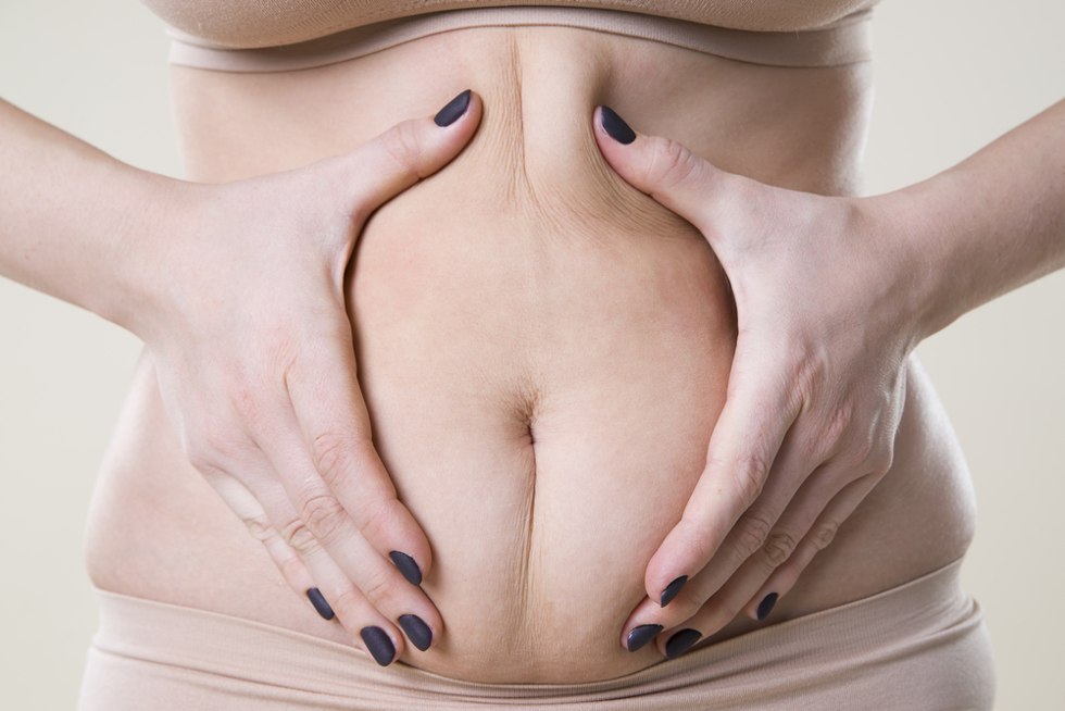 Abdominoplasty: Tummy Tuck Side Effects, Cost & More