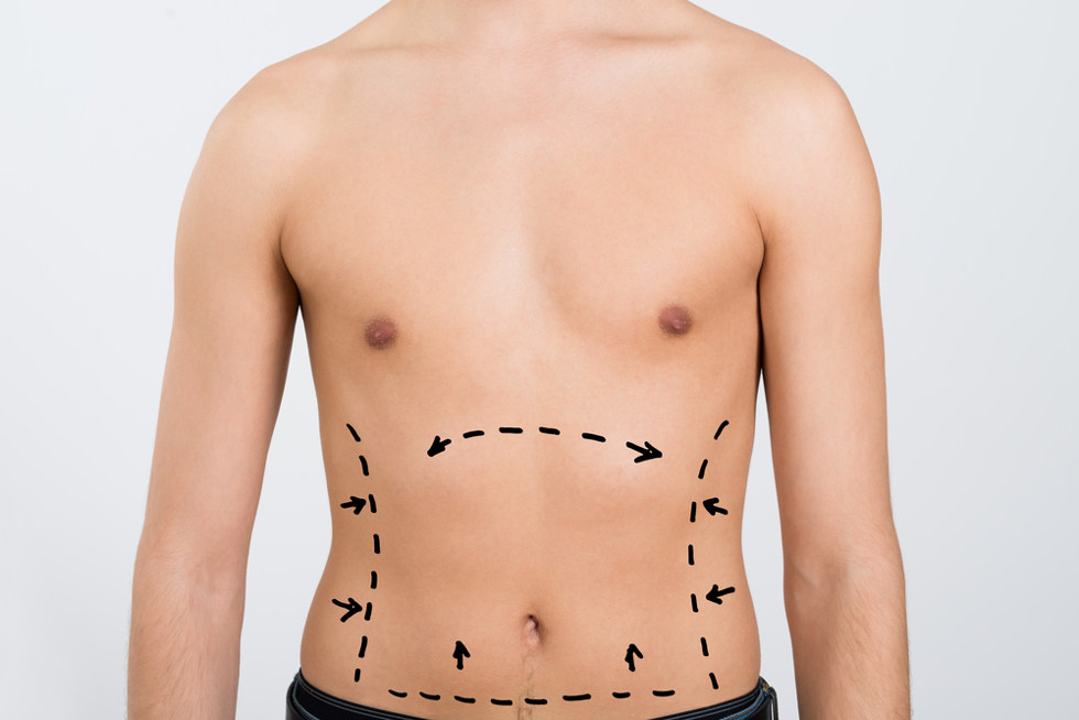 where fat is commonly taken in men 