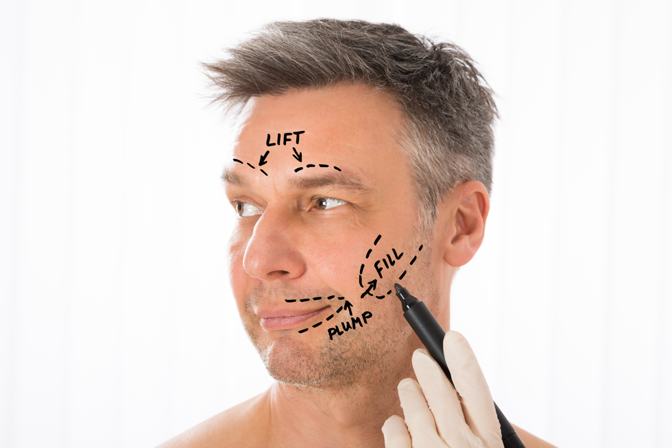 male facelift